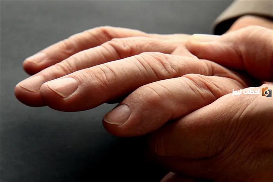 علاج تورم الاصابع بالأعشاب بوصفة منزلية سريعة