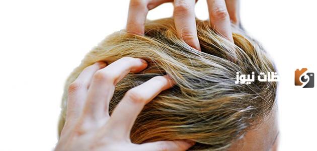 كيف أتخلص من حكة الرأس والقشرة