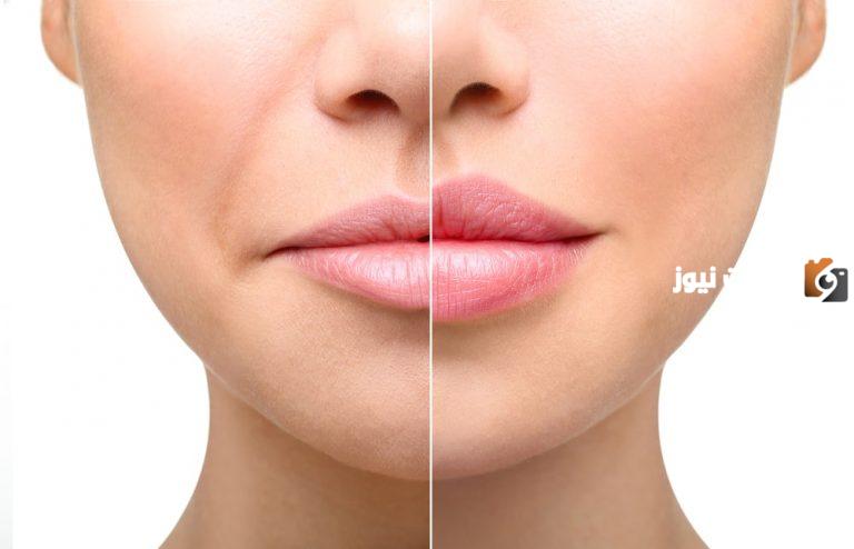 كيف أحصل علي شفاه جذابة بدون عمليات تجميلية للوجه