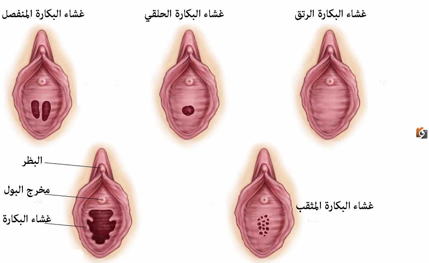 كيف شكل غشاء البكارة السليم