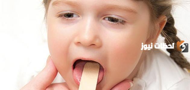 علاج التهاب الحلق