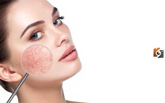 هل يوجد مستحضرات تجميل للبشرة الحساسة؟ وما هي أضرارها؟