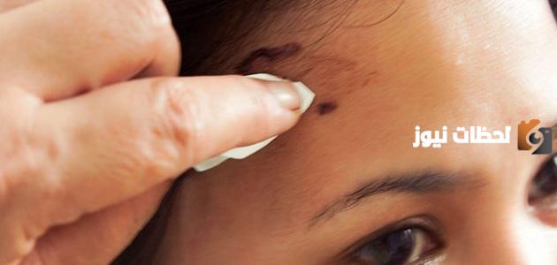 وصفات إزالة صبغة الشعر من اليدين والوجه في المنزل