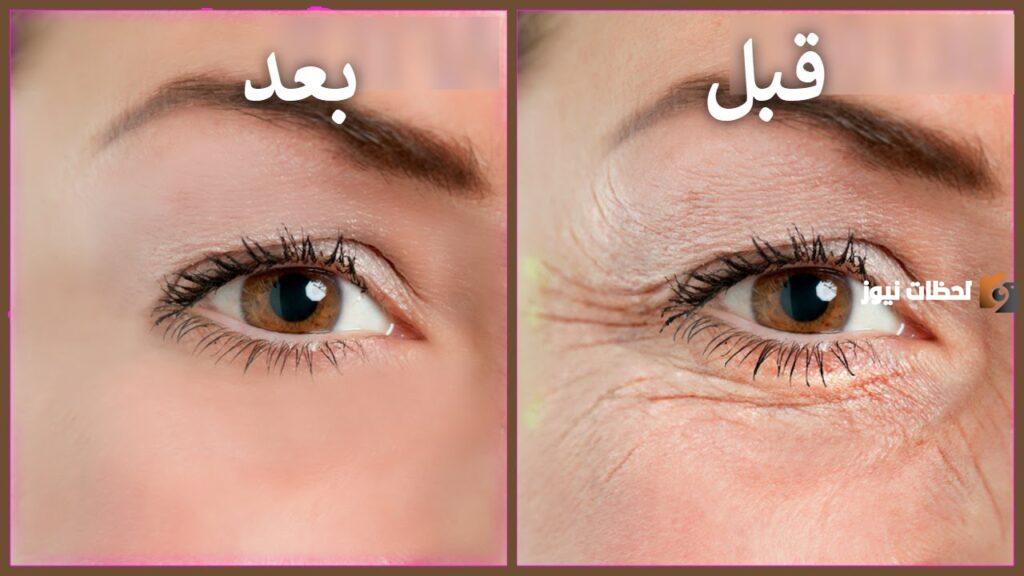 وصفات للتخلص من التجاعيد والانتفاخ تحت العين