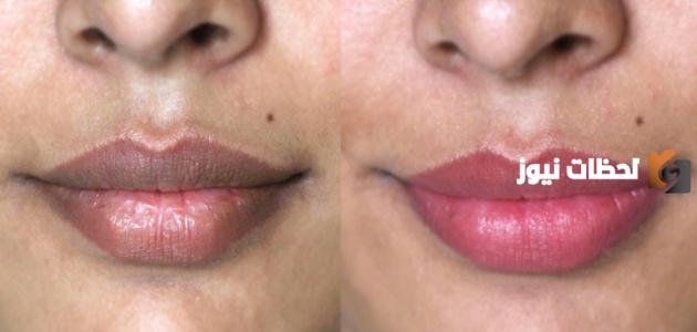 خلطات طبيعية للتخلص من اسمرار الشفايف