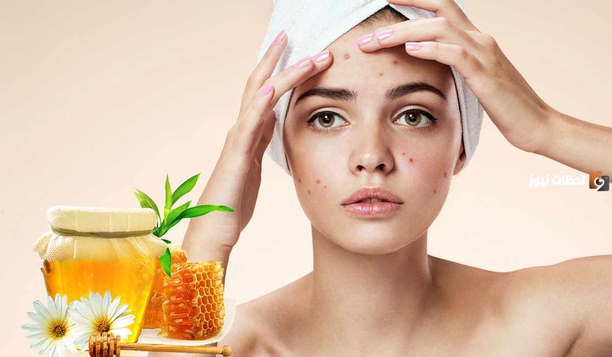 استعمال العسل للوجه