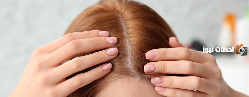 كيف تتم زراعة الشعر
