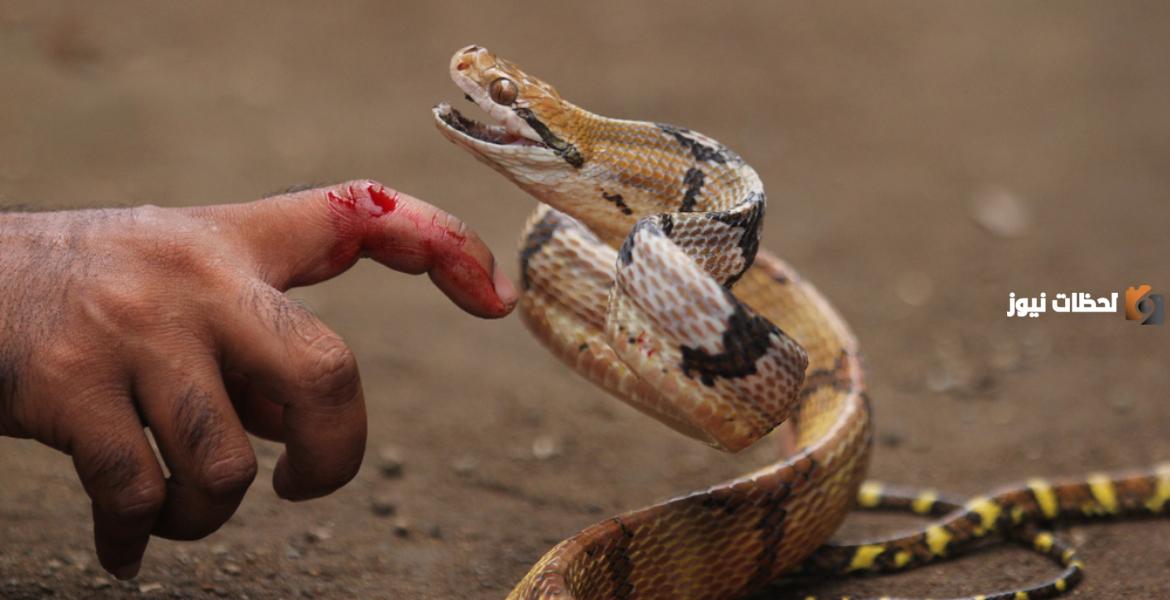 لدغة الافعى