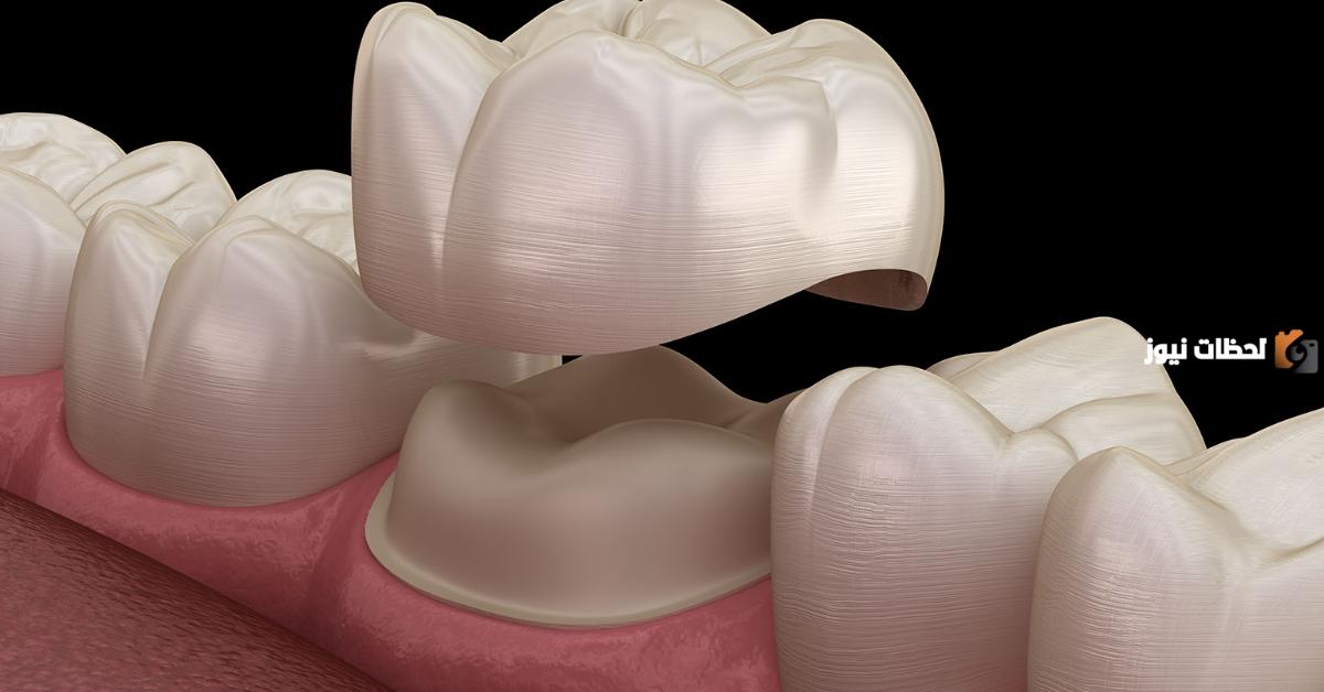هل يمكن إزالة التسوس من الأسنان؟! أفضل طرق علاج تسوس الأسنان هل يمكن إزالة التسوس من الأسنان؟! أفضل طرق علاج تسوس الأسنان