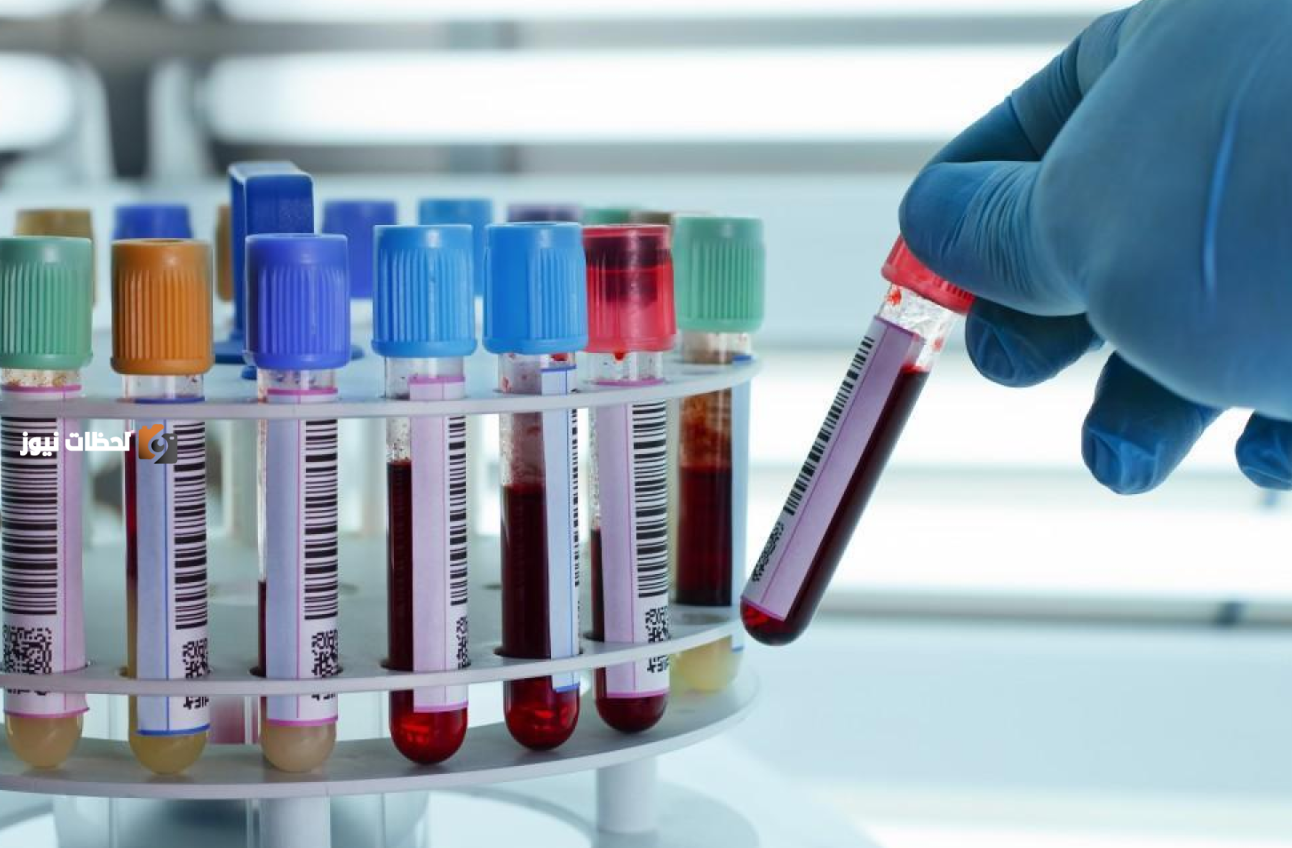 اختبار دم يكشف سرطان القولون في مراحله المبكرة بفاعلية عالية