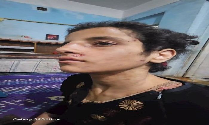 يرى فيها صورة زوجته الأولى.. السجن عامين لأب وزوجته عذبا طفلته في المنوفية