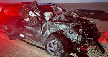 تركيب شرائح ومسامير في قدم طفل إثر حادث لإسماعيل الليثي