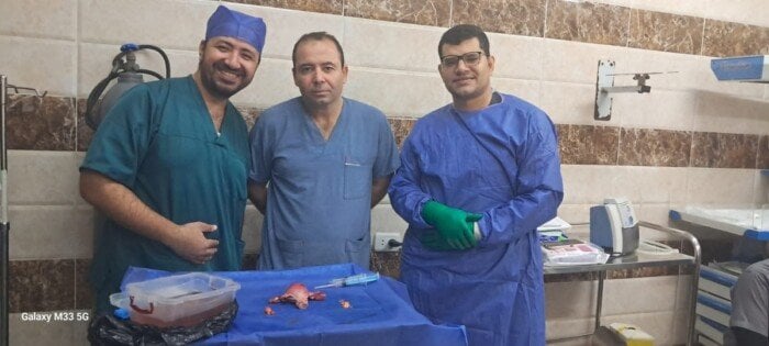 مستشفيات جامعة بني سويف تنجح في جراحة كبرى لتحديد مرحلة ورم خبيث في بطانة الرحم