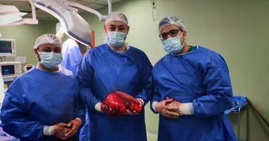 نجاح مستشفى بني سويف في إزالة ورم سرطاني من فخذ مريض كبير السن